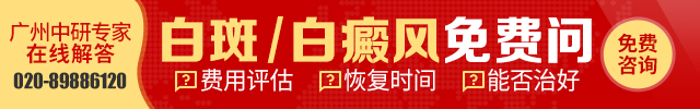 白斑、白癜风免费问-广州中研640-100.jpg